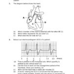 Ekg Practice Worksheet With Answers