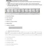 Printable Ekg Test And Answers